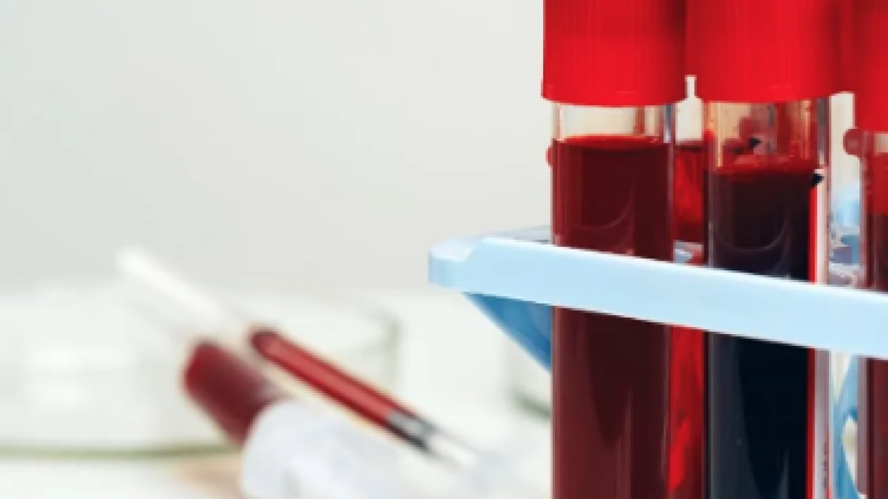 Foto - Japon bilim adamları açıkladı! Zeka fışkıran kan grubu: Japonya'da çok yaygın, başarılı oluyorlar En zeki ve akıllı kan grubu 