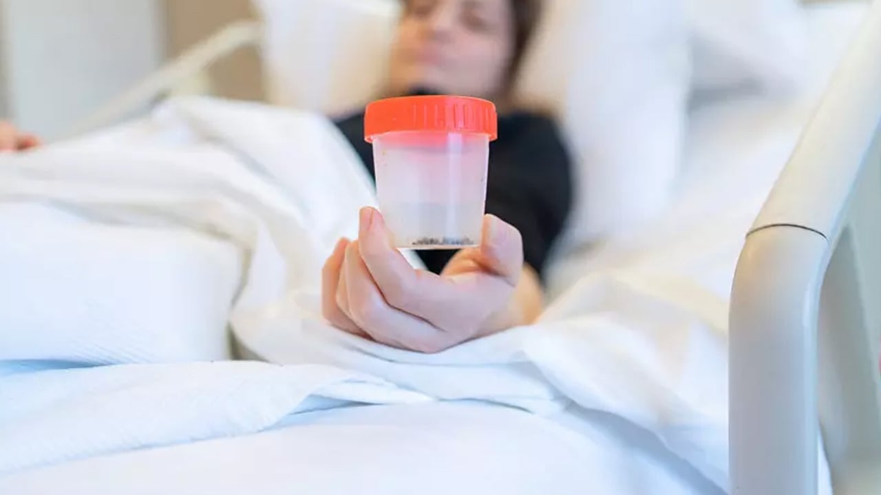 Foto - Kadınlarda böbrek taşı görülme oranı artıyor: Tüketenler risk altında! Acı biber büyük önem taşıyor 