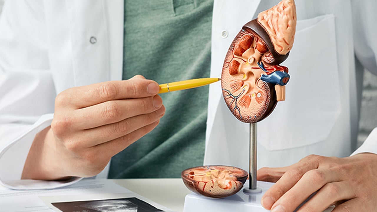 Foto - Kadınlarda böbrek taşı görülme oranı artıyor: Tüketenler risk altında! Acı biber büyük önem taşıyor 