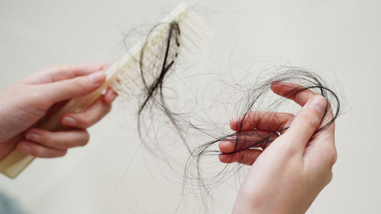 Foto - Kadınlarda saç dökülmesinin gerçek sebebi! Saçınız değil, sağlığınız dökülüyor olabilir