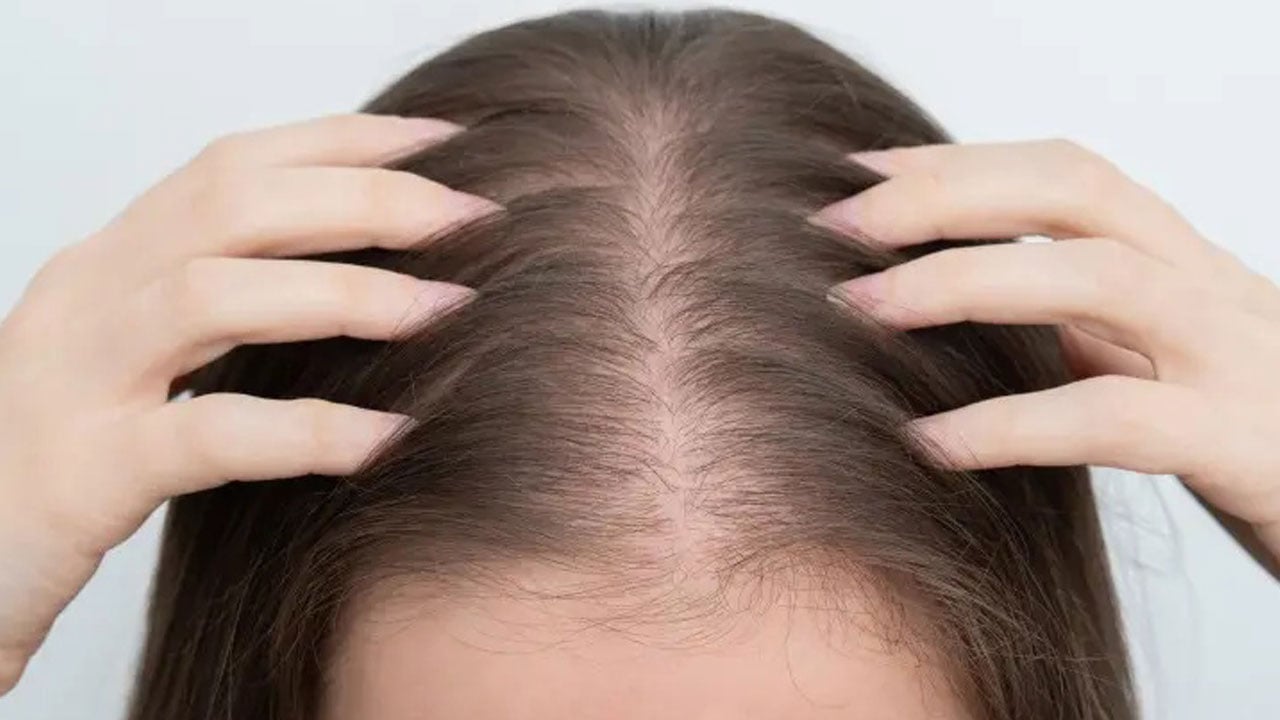 Foto - Kadınlarda saç dökülmesinin gerçek sebebi! Saçınız değil, sağlığınız dökülüyor olabilir