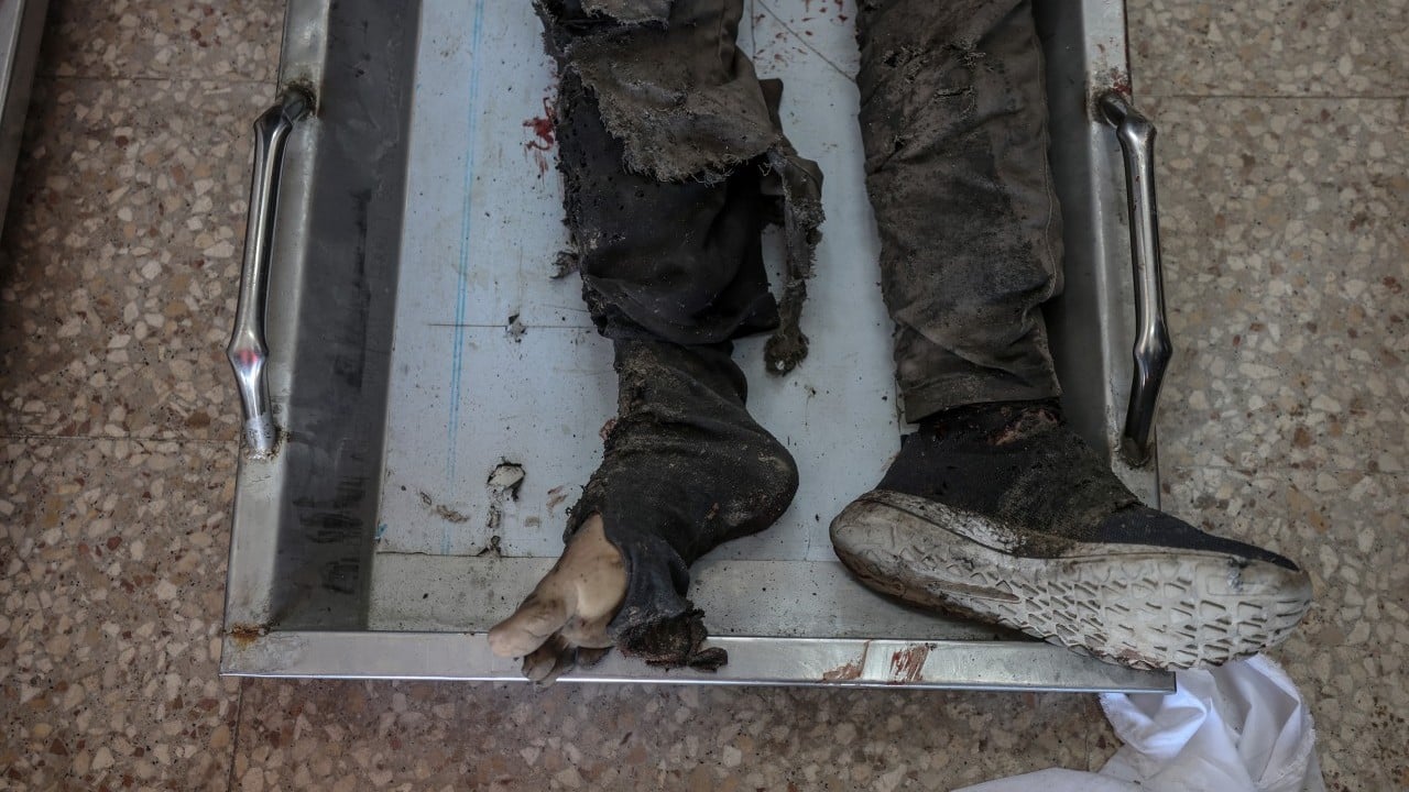 Foto - Kahpe İsrail yine Gazze'yi vurdu!