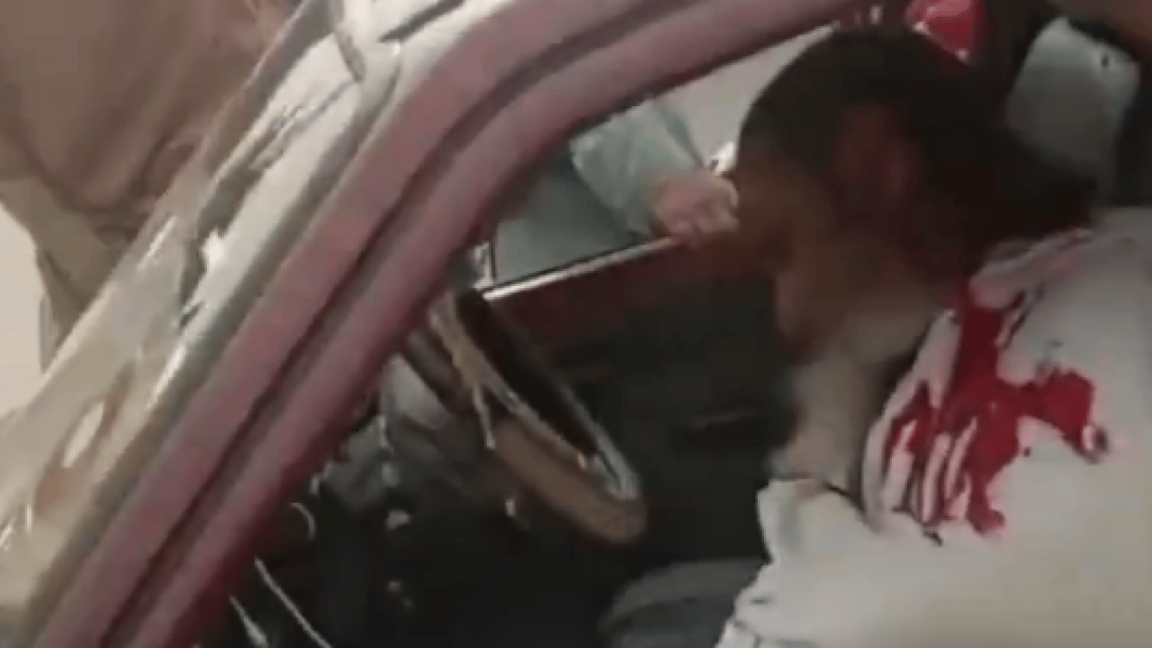 Foto - Kahreden gelişme: Ünlü din adamı suikaste uğradı