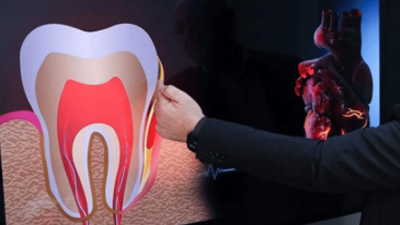 Foto - Kalp kapak hastaları için hayati risk taşıyor! Diş eti iltihabı ölümcül olabilir