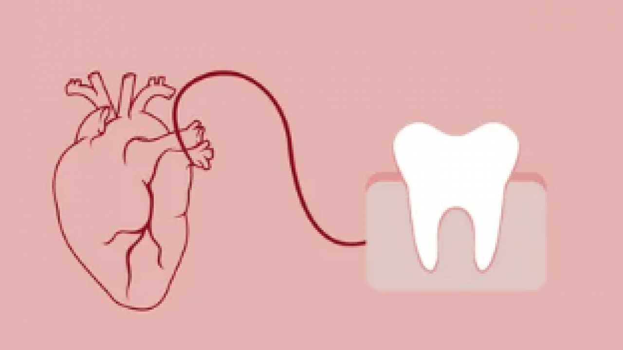 Foto - Kalp kapak hastaları için hayati risk taşıyor! Diş eti iltihabı ölümcül olabilir