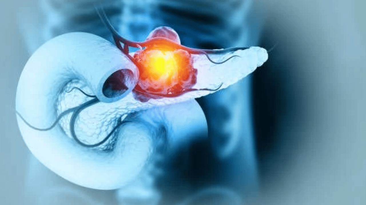 Foto - Kan şekeri neden düşer? İşte ani şeker düşmesinin sebepleri