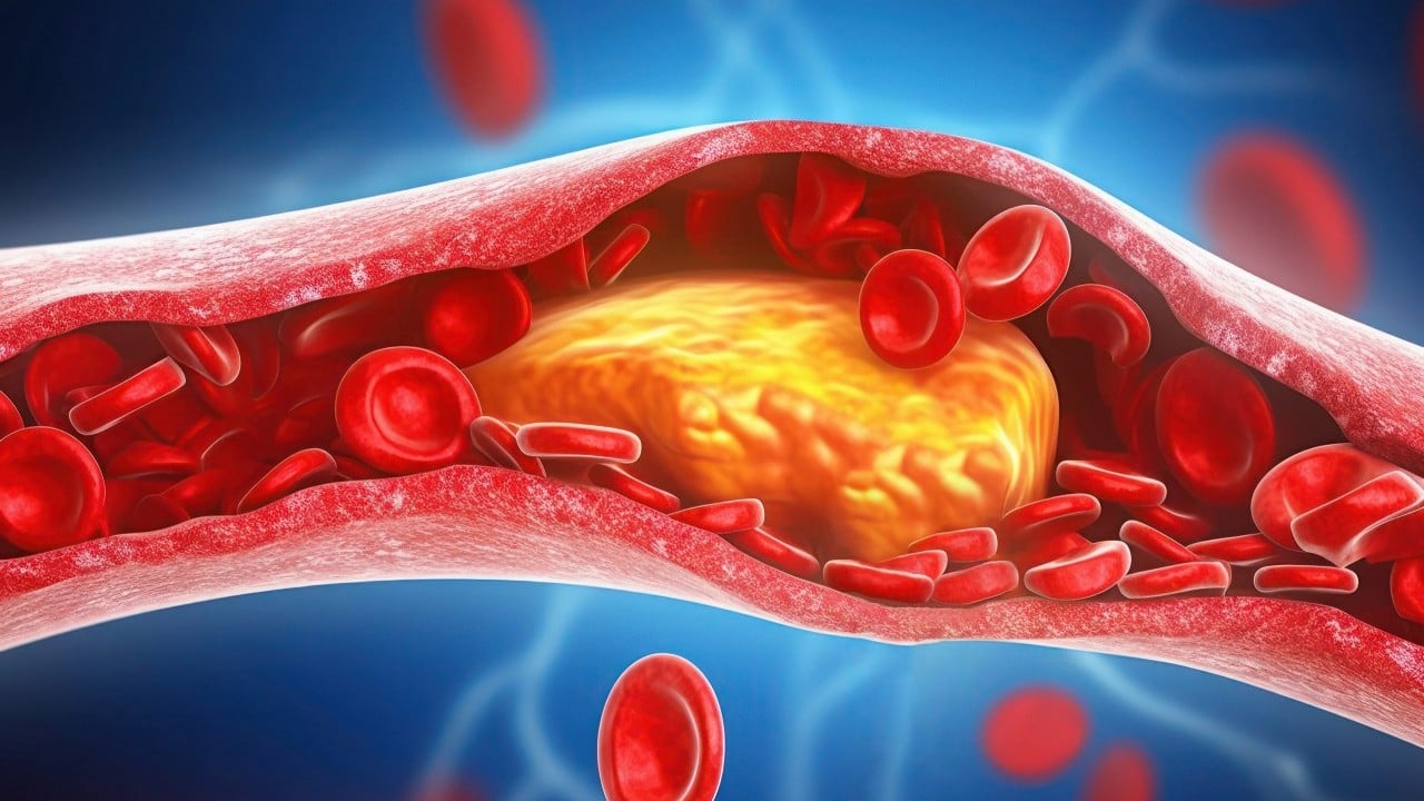 Kan testinde şaşırtan sonuç: Beklenmedik kolesterol gerçeği ortaya çıktı