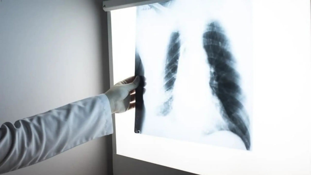 Foto - Kanserde oyun değişti: Yok etmek yerine onarmak