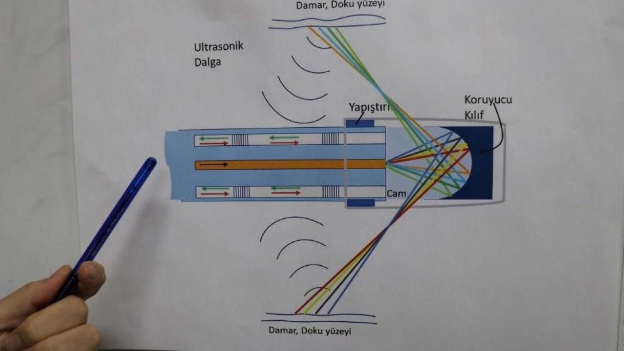 Foto - Kanserli hücreler biyopsi olmadan tespit edilecek