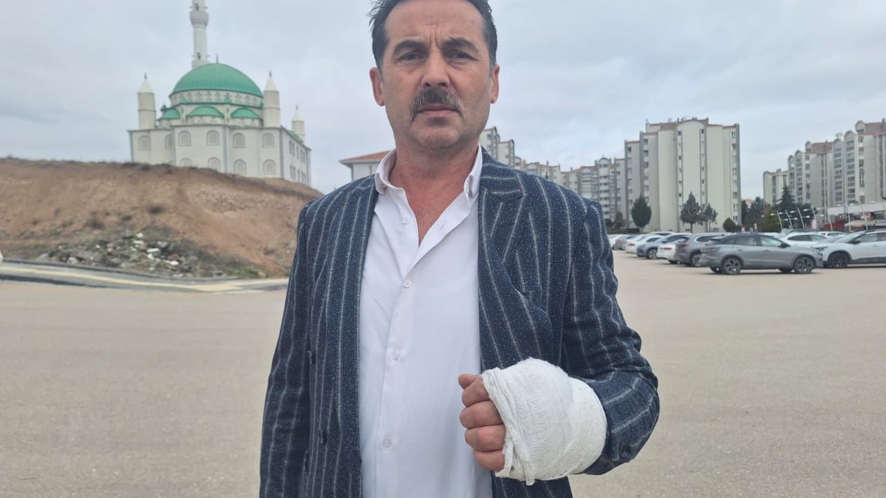 Foto - Kaputun üzerinde 20 kilometre ölüm yolculuğu! Tüm Türkiye'nin gündemindeydi