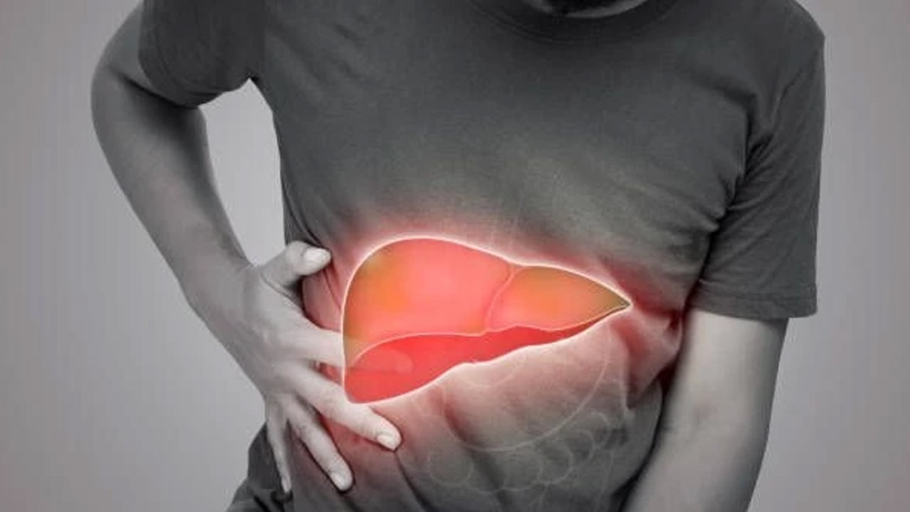Foto - Karaciğerde görülen bu belirtilere dikkat: Tıpta adı değişti ama çağın en sinsi hastalığı! Çoğu kimse bunu bilmiyor