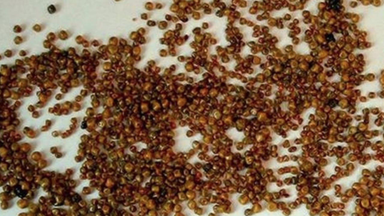 Foto - Karı koca aynı hastalıktan aynı gün ameliyat oldu: Şimdi 20, 22, 25 yaşları seviyesine indi...