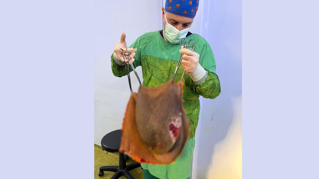 Foto - Karnından 40 kilogram kitle çıkarıldı! Bu kez sevinçten ağladı