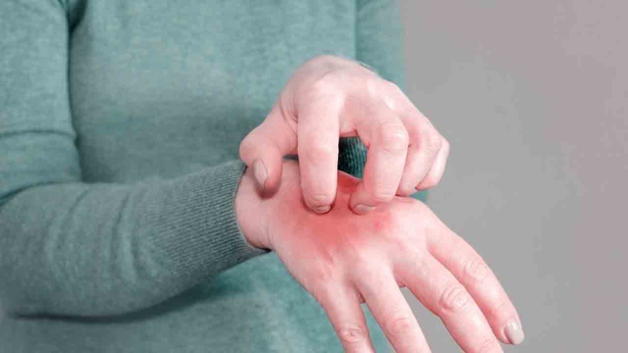 Foto - Kaşıntı kabusu geri döndü: Uyuz vakaları tırmanışta