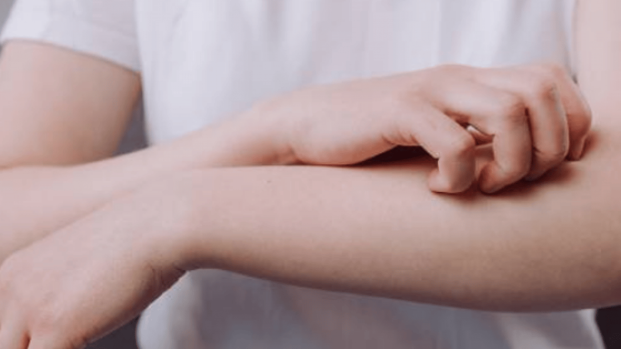 Foto - Kaşıntıya naneli çözüm! Kaşıntıya karşı öneri: Hem pişirin hem suyunu kullanın diyor! İşte formül, kullanım süresi