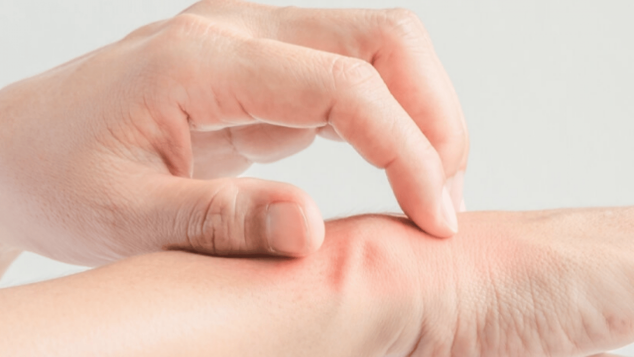 Foto - Kaşıntıya naneli çözüm! Kaşıntıya karşı öneri: Hem pişirin hem suyunu kullanın diyor! İşte formül, kullanım süresi