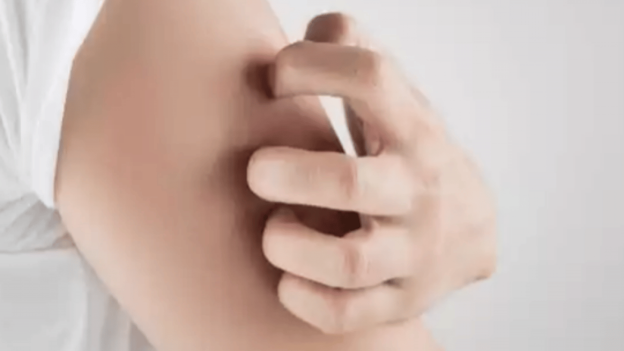 Foto - Kaşıntıya naneli çözüm! Kaşıntıya karşı öneri: Hem pişirin hem suyunu kullanın diyor! İşte formül, kullanım süresi