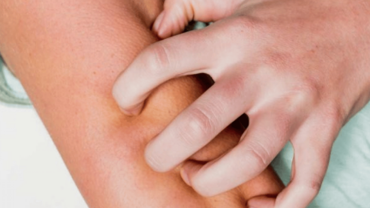 Foto - Kaşıntıya naneli çözüm! Kaşıntıya karşı öneri: Hem pişirin hem suyunu kullanın diyor! İşte formül, kullanım süresi