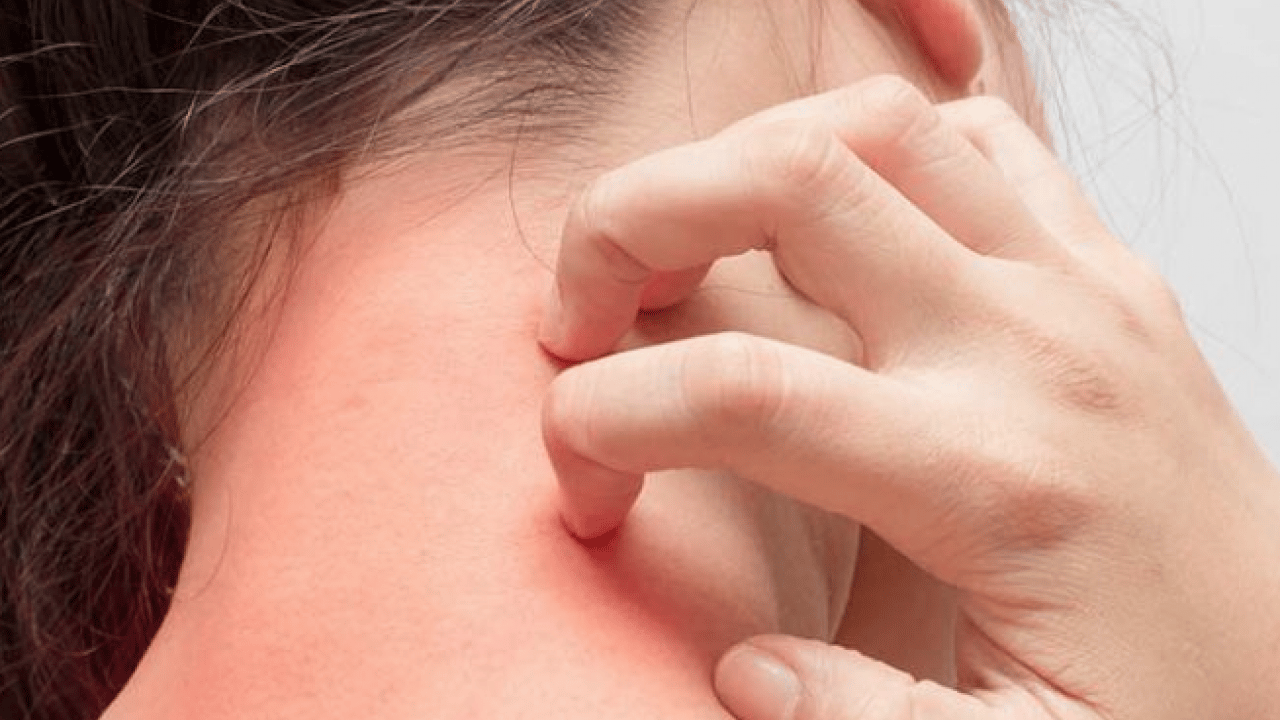 Kaşıntıya naneli çözüm! Kaşıntıya karşı öneri: Hem pişirin hem suyunu kullanın diyor! İşte formül, kullanım süresi