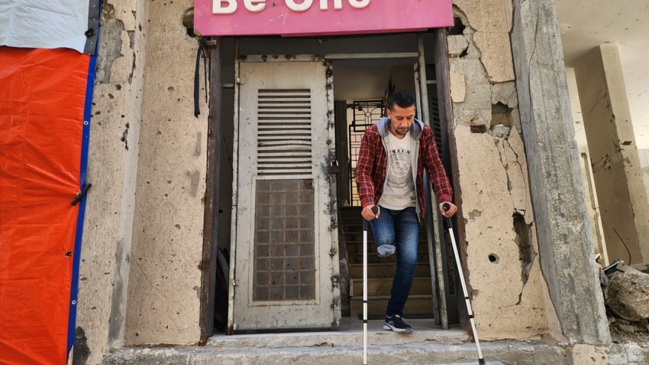 Foto - Katil devlet İsrail’in saldırısında bacağını kaybetmişti! Filistinli antrenör, sporla hayata tutunuyor
