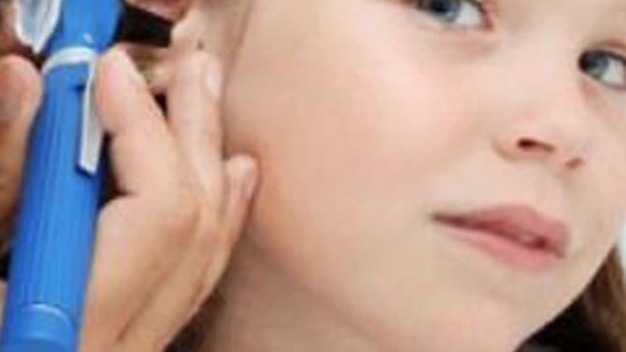 Foto - KBB uzmanı açıkladı: Çocuklarda kulakta sıvı birikimi sessiz ilerleyebilir