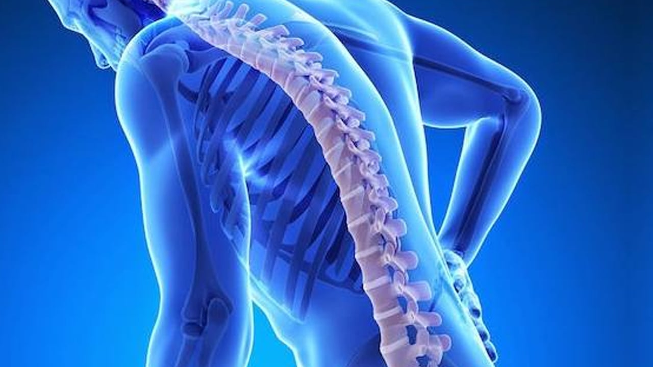 Kemik erimesi olarak bilinen Osteoporoz yatağa mahkum ediyor! Kemik erimesine karşı 7 etkili öneri