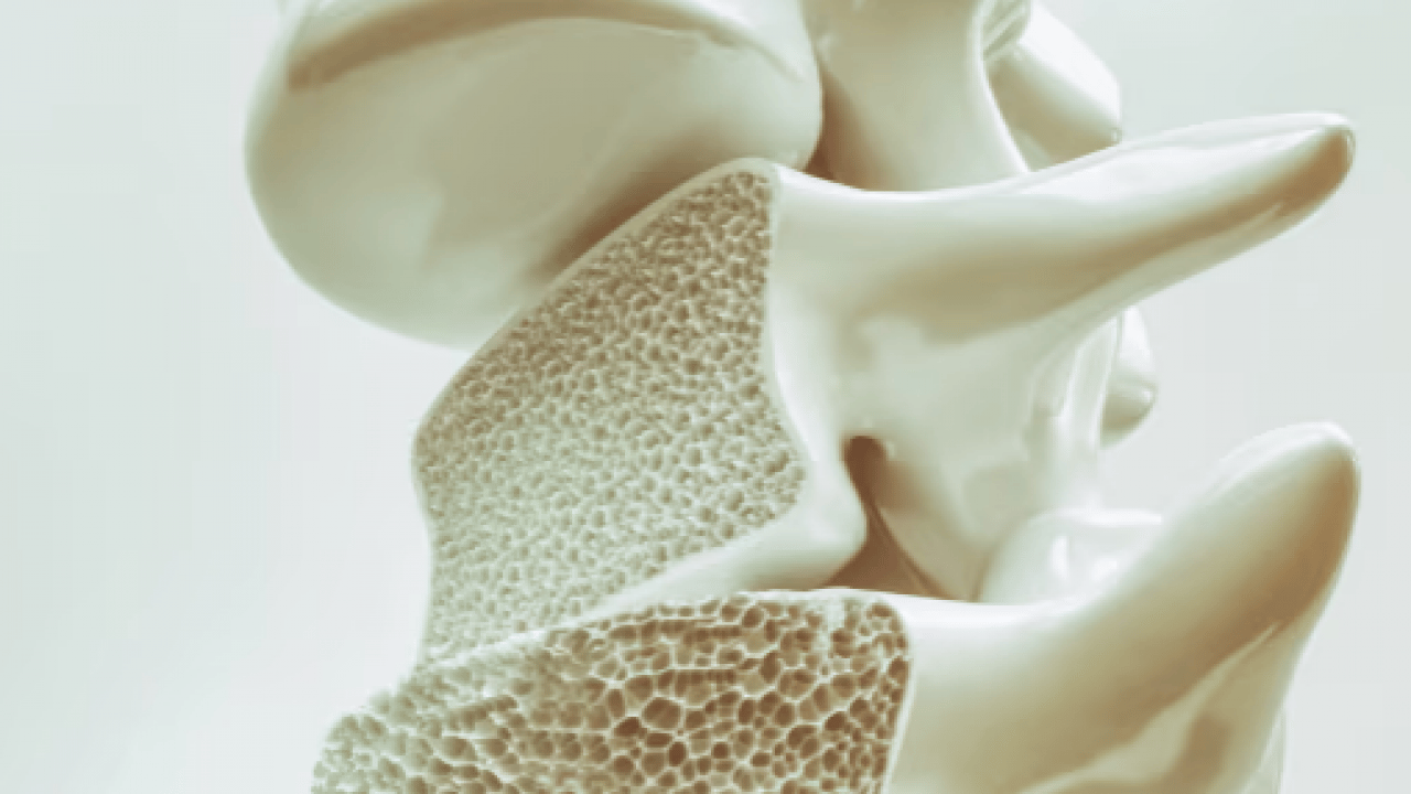 Foto - Kemik erimesine kesin çözüm: Herkesin aklındaki soru! Cevap vereceği konuşuluyor