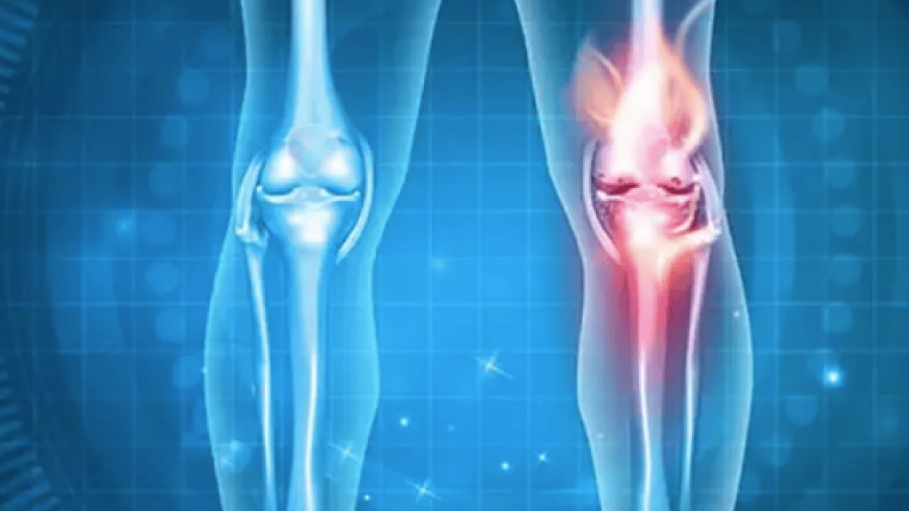 Kemik erimesine kesin çözüm: Herkesin aklındaki soru! Cevap vereceği konuşuluyor