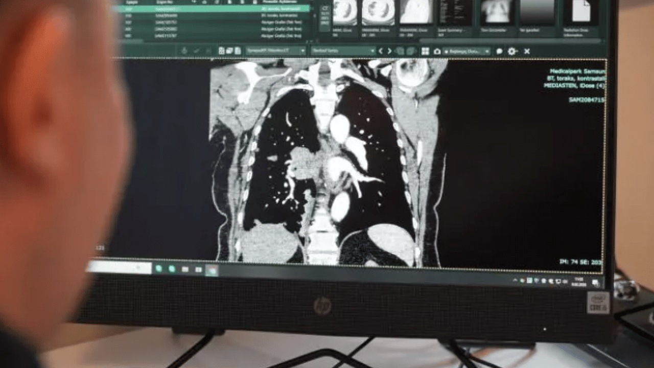 Kendi sonumuzu kendimiz hazırlıyoruz: Yüzde 37 önlenebilir!