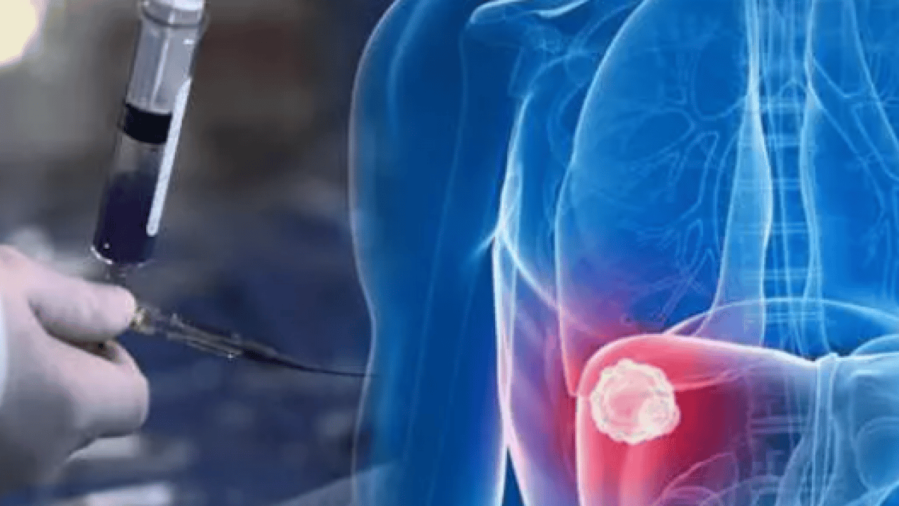 Foto - Kendi sonumuzu kendimiz hazırlıyoruz: Yüzde 37 önlenebilir!