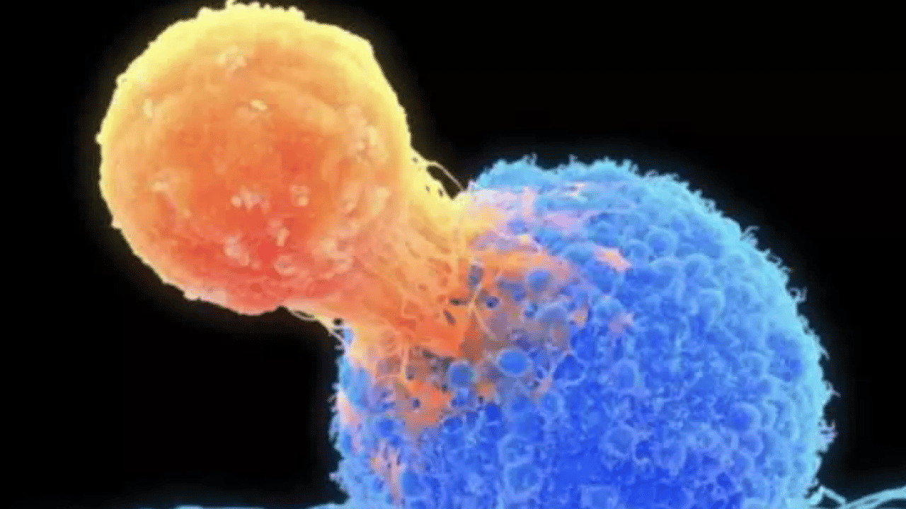 Foto - Kendi sonumuzu kendimiz hazırlıyoruz: Yüzde 37 önlenebilir!