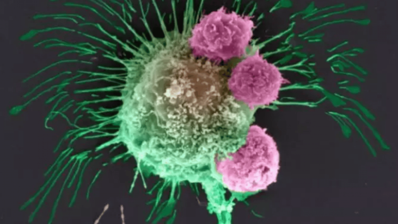 Foto - Kendi sonumuzu kendimiz hazırlıyoruz: Yüzde 37 önlenebilir!