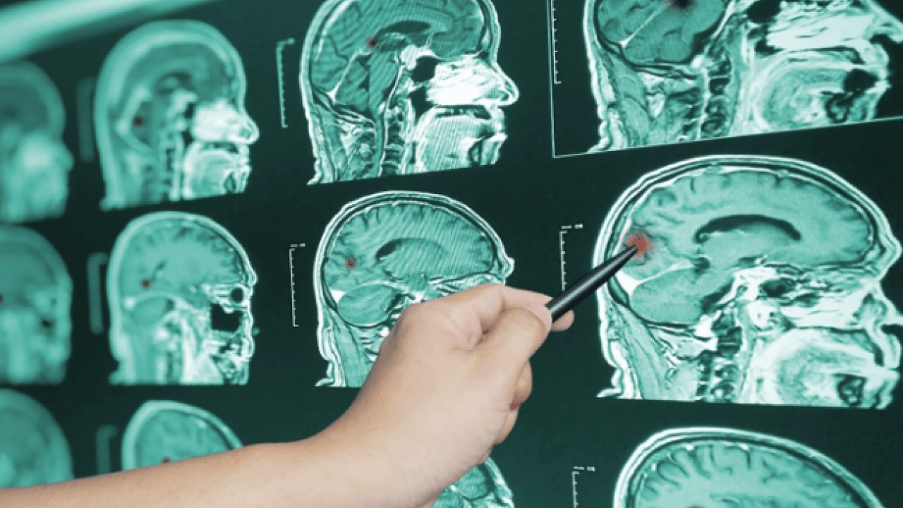 Foto - Kimi sağlıklı diyor kimi sağlıksız diyor! Kahvenin insanlar üzerindeki etkisi açıklandı