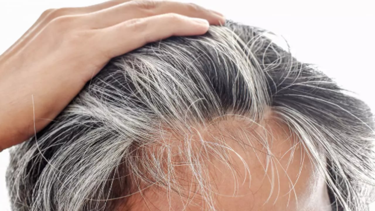 Foto - Kimyasallara para vermeyin: İşte beyaz saçları kapatan ev yapımı tarif!