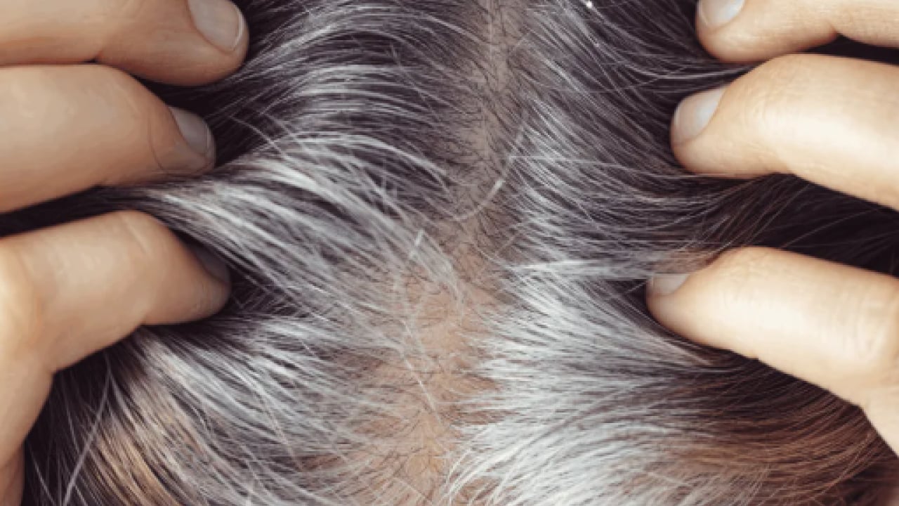Foto - Kimyasallara para vermeyin: İşte beyaz saçları kapatan ev yapımı tarif!