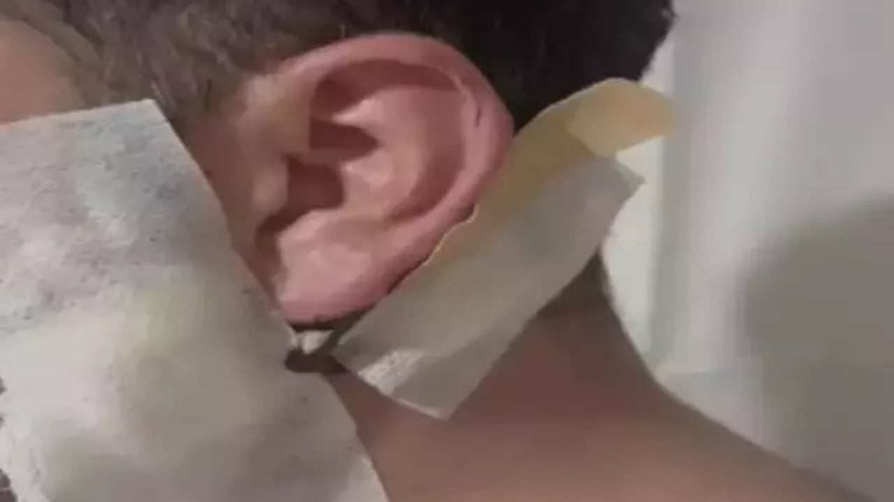 Foto - Kiracıdan ölüm tuzağı! Banyoda saklandı, sap kırıldı, o an hayatı kurtuldu