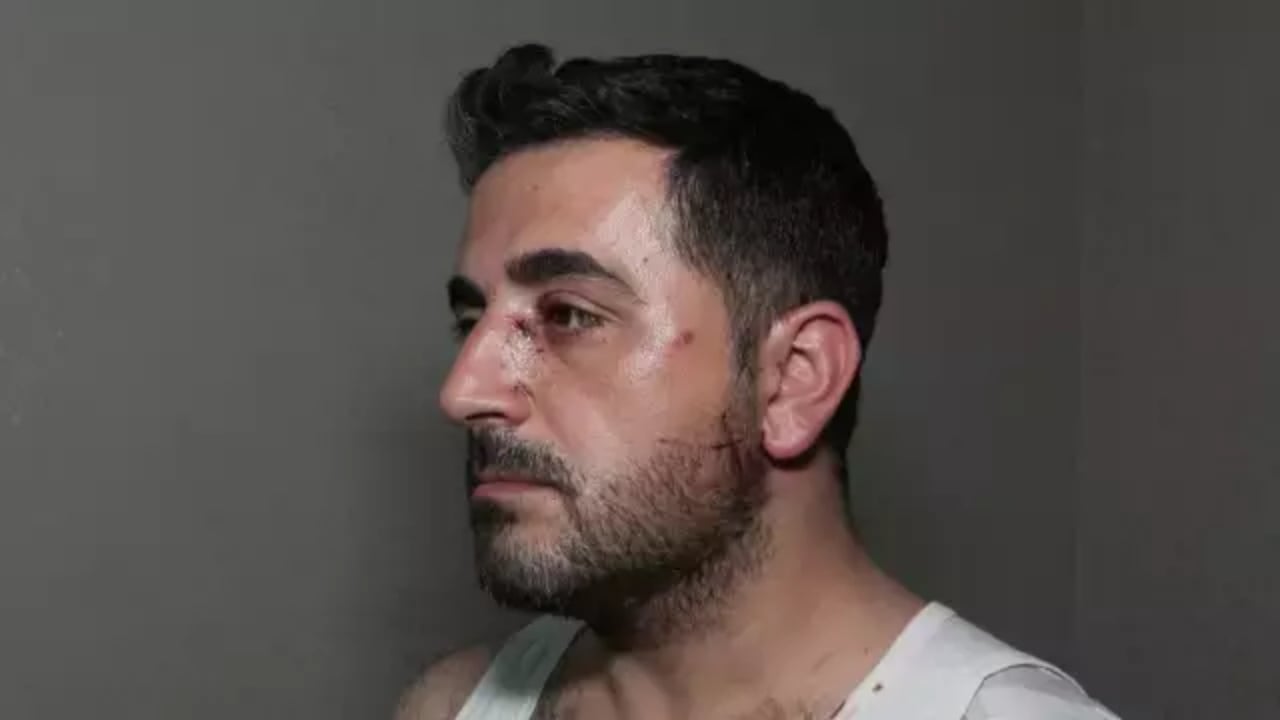 Foto - Kiracıdan ölüm tuzağı! Banyoda saklandı, sap kırıldı, o an hayatı kurtuldu