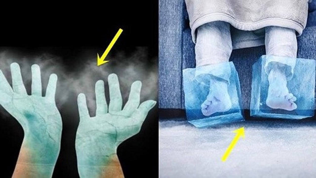 Kış boyu sıcacık tutacak! El ve ayaklarda üşümeye iyi gelen 4 yöntem