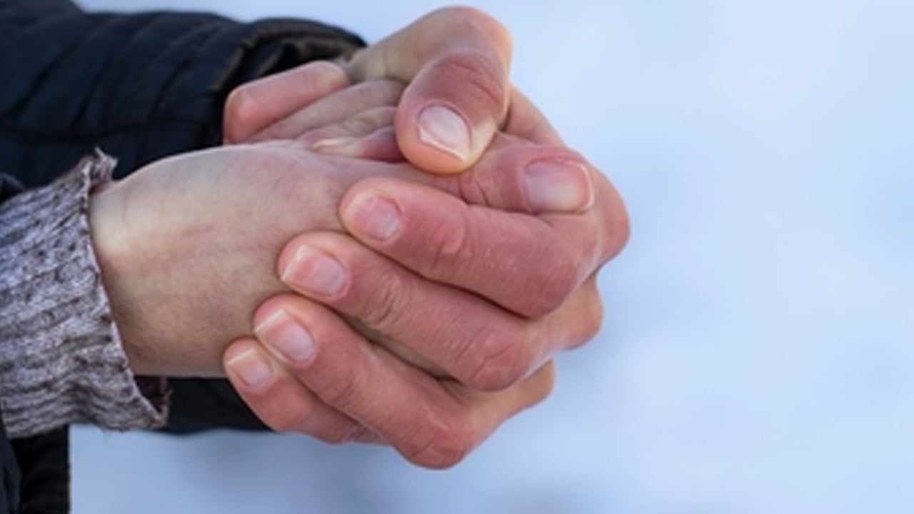 Foto - Kış sert geliyor dikkat! Kışın en kötü hastalık bu: Basit kızarıklık deyip geçmeyin! 