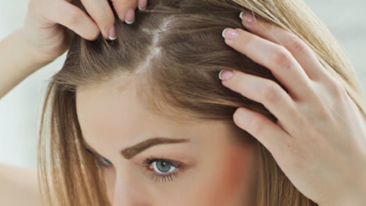 Foto - Saç dökülmesi artıyorsa mutlaka deneyin: En çok uygulanan doğal formül etkisini sürdürmeye devam edecek
