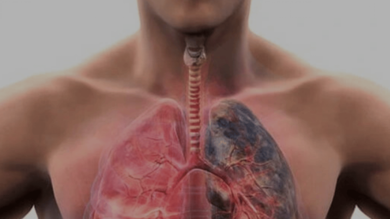 Foto - KOAH riski sigara ile artıyor! Uzmanı tek tek uyardı, aman dikkat artık... 