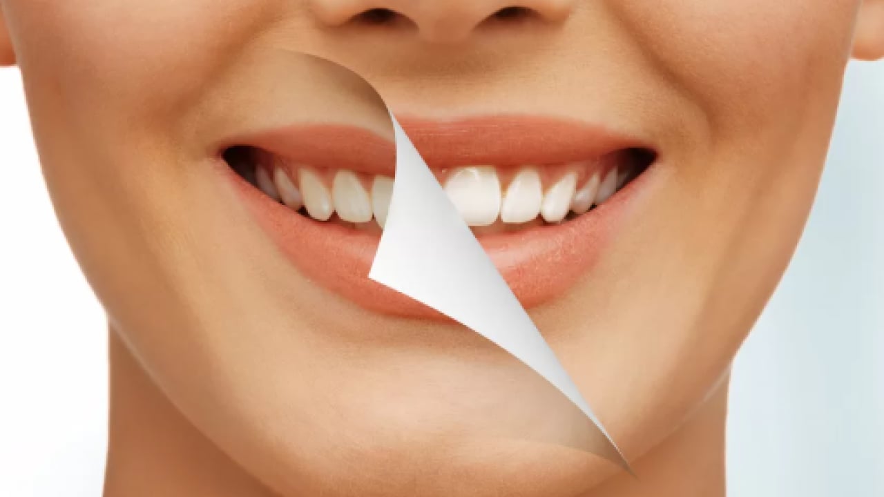 Foto - 'Kolay peynir fare kapanında olur' Sosyal medyada 'beyaz diş' oyunu