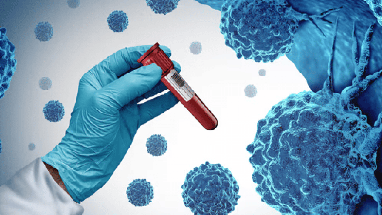 Kolorektal kanser uyarısı: Sağlık Bakanlığı uyardı: Her yıl yaklaşık 1,9 milyon yeni vaka...