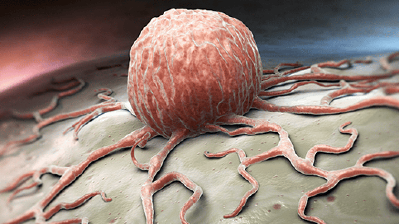 Foto - Kolorektal kanser uyarısı: Sağlık Bakanlığı uyardı: Her yıl yaklaşık 1,9 milyon yeni vaka...