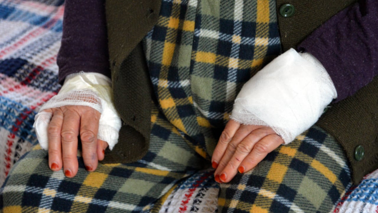 Foto - Komşu değil, canavar! 85 yaşındaki kadının boğazına bıçak dayayıp bileziğini çaldı!