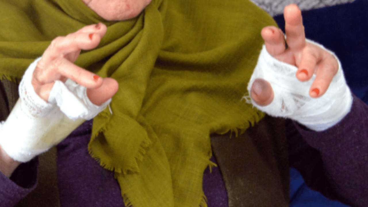 Foto - Komşu değil, canavar! 85 yaşındaki kadının boğazına bıçak dayayıp bileziğini çaldı!