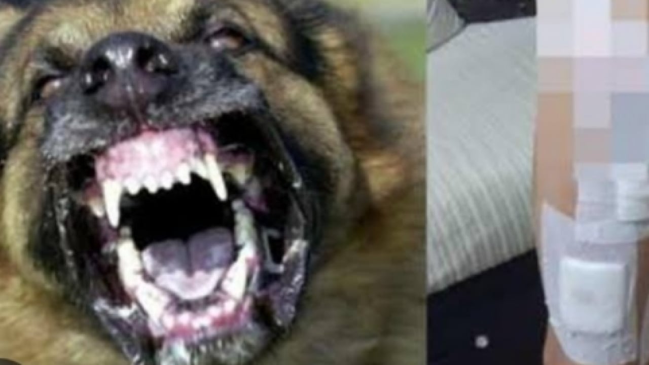 Foto - Köpek terörü 8 yaşındaki sabiyi parçalıyordu! Bakanlık harekete geçti