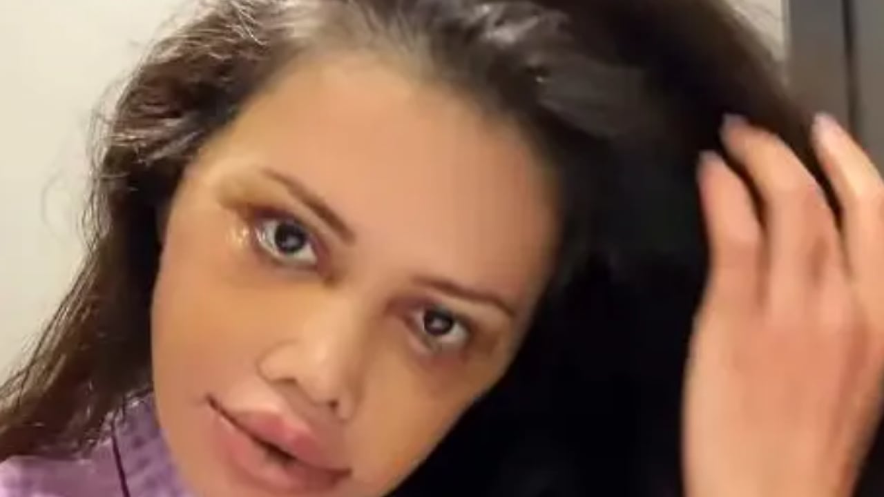 Foto - Kore'de estetik oldu diye başına gelmeyen kalmadı! Ölüm mesajları alıyor!
