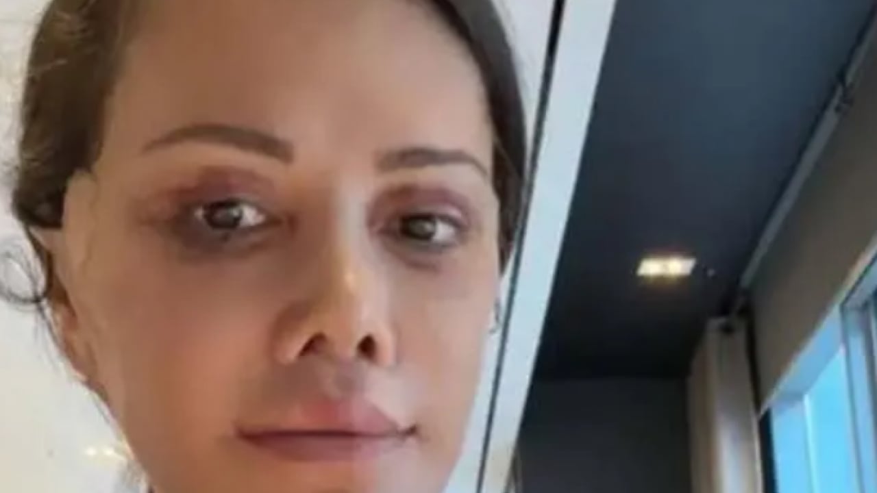Foto - Kore'de estetik oldu diye başına gelmeyen kalmadı! Ölüm mesajları alıyor!