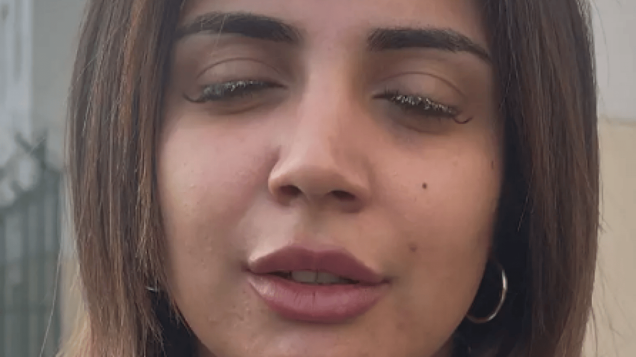 Foto - Korkunç olay: Kirpiklerini yaptırmaya gitti ama gözlerini yaktı... Kör olabilirdim! Görenleri şaşkına çevirdi